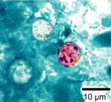 Microscope image of stained Cyclospora cayetanensis oocysts, the parasite behind the outbreak